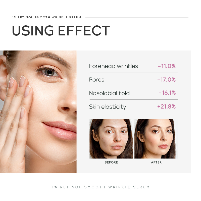 Quiyum 1% Retinol Smooth Wrink - đánh giá và giá Niacinamide Brightening Serum